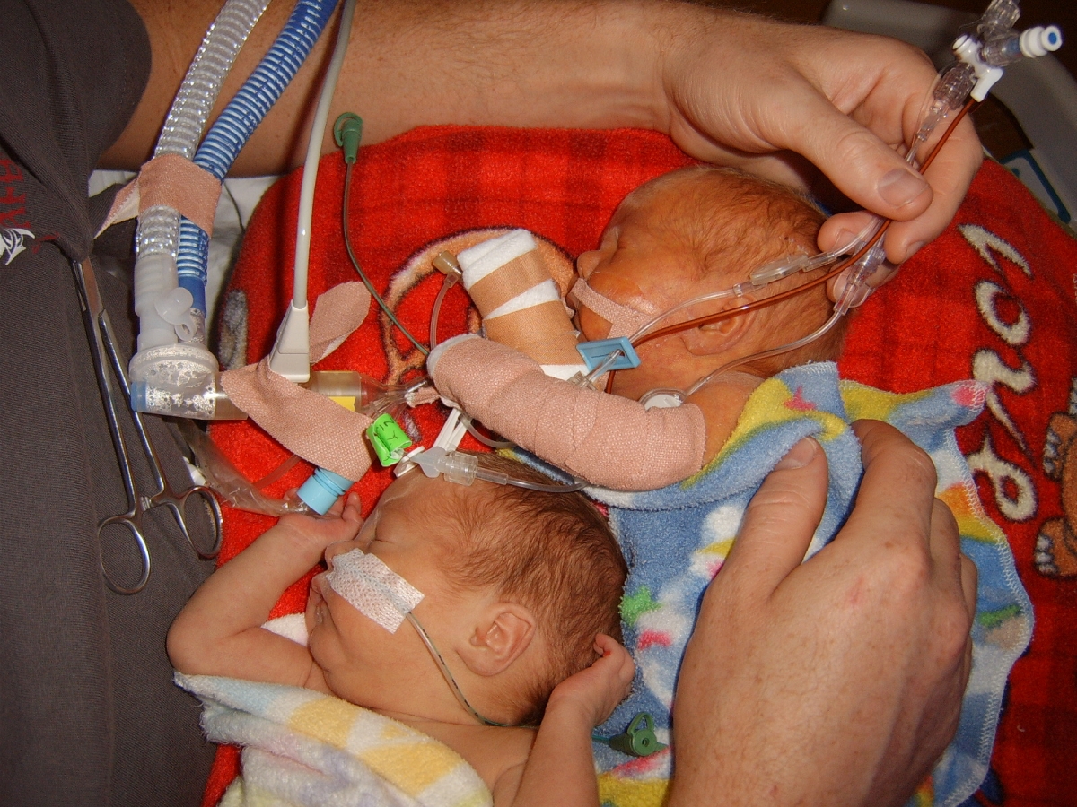 Rigby NICU Twin shot